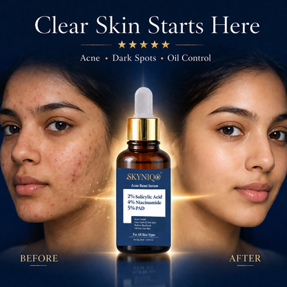 SKYNIQO Acne Reset Serum (30ml)